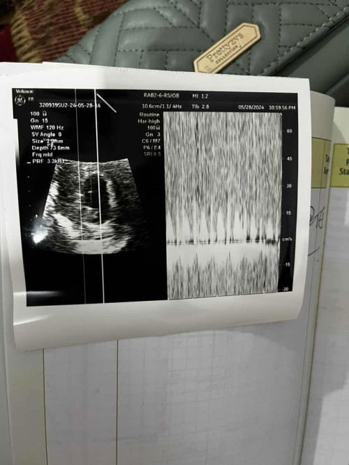 Usg 7week ada yg sama kah bun?