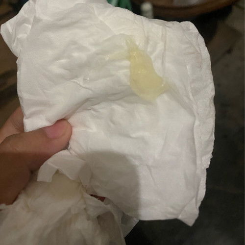 Hamil 38 week 4 hari