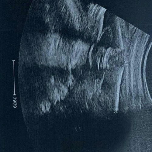 แบบนี้ผู้ชายไหมคะลองกลับหัวดูนะคะว่าใช่มั้ย