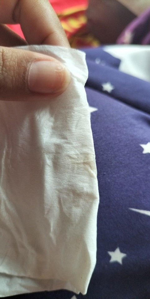 แบบนี้ปกติไหมคะ