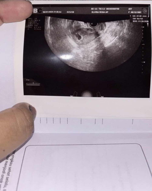 Kata dokter 5w tapi di app 6w