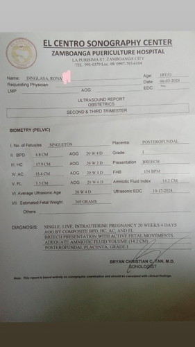 Ano po ibig Sabihin nang BREECH??