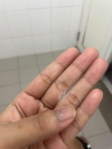 Mucus Plug