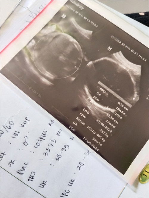 Hpl maju, tipsnya supaya bayi cepet lahir