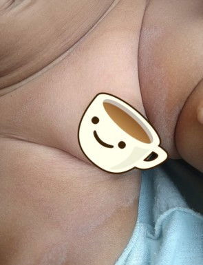 Kenapa selangkangan anak seperti ini