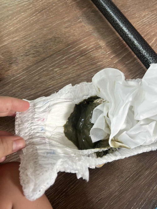 อึน้องเป้นสีเขียวขี้ม้ามีสีเหลืองป่นนิดหน่อย