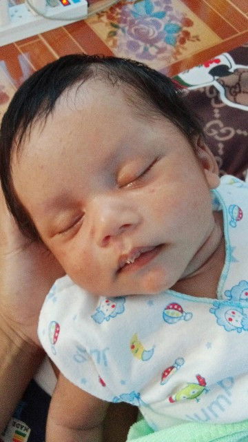 เวลาน้องปากแห้ง แม่ๆทำยังไงกันคะ ทาอะไรให้น้องมั้ย