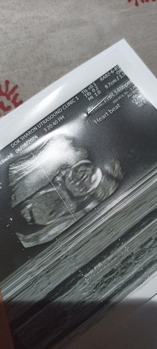 ultrasound