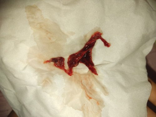 Maaf foto agak jorok