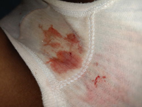 Sering pengalaman bunda nya?