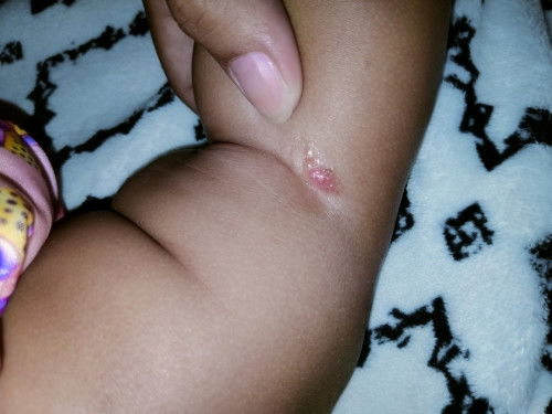 แบบนี้ข้อพับขาเปลือยใช่มั้ยคะ