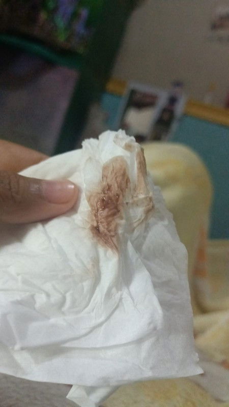 Flek 6 w.flek setiap habis berdiri