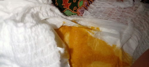 BAB Bayi 4 Bulan 16 hari Encer