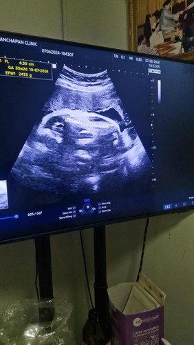 33+4 วีค น้องน้ำหนัก 2,433 แบบนี้มาตรฐานหรือเยอะไปหรือเปล่าคะ
