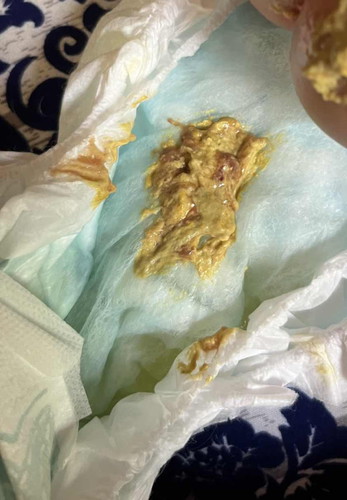 1month old poop after immunization