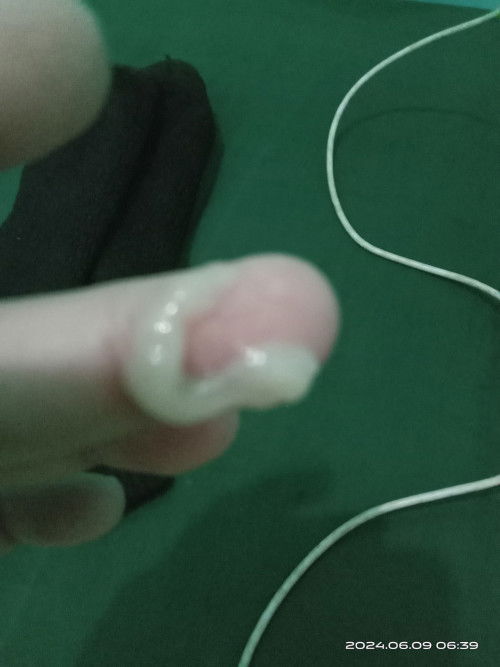 Lendir putih tp tidak berdarah