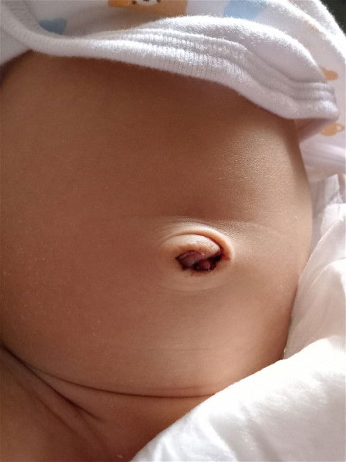 แบบนี้คือโดนดึงออกใช่มั้ยคะหรือหลุดเอง