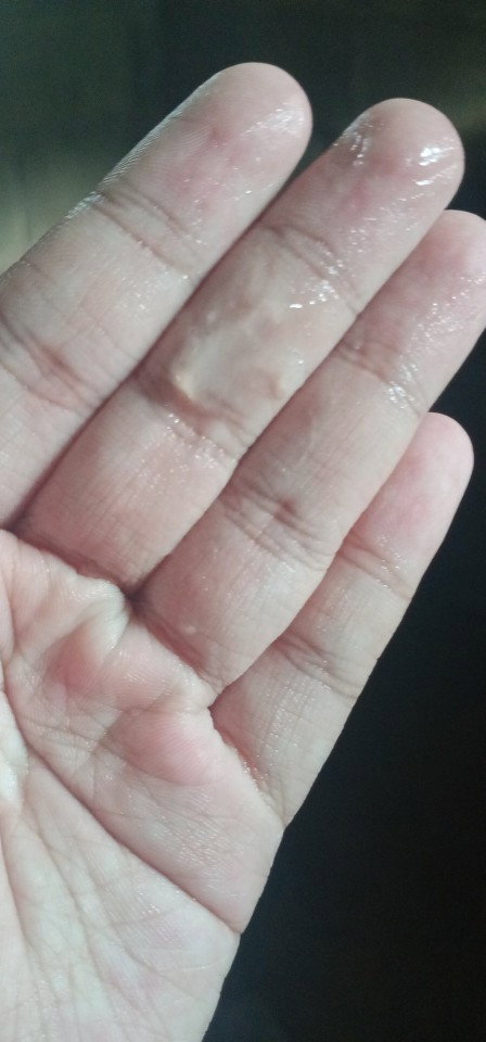 มูกแบบนี้ใกล้คลอดไหมคะ 39+6w พรุ้งนี้กำหนดคลอดคะ