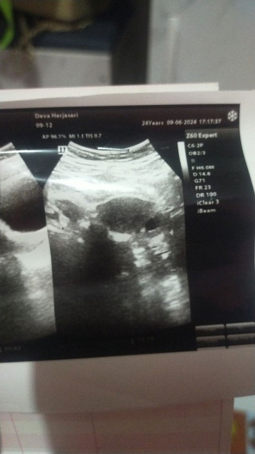 hasil usg tadi sore