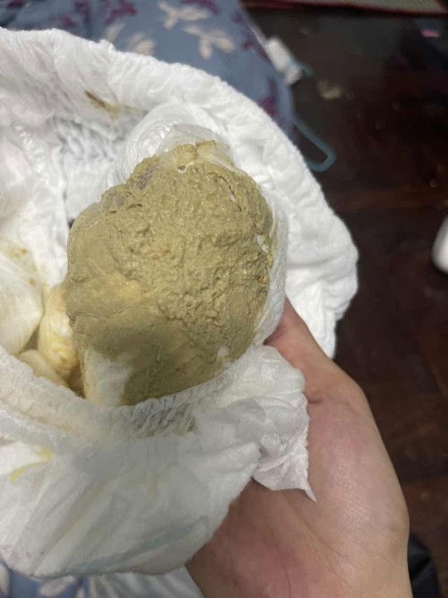 ลูก1ขวบ19วัน ทานกล่องของนมโฟโมท สีทองสูตร1 อึสีนี้ปกติมั้ย