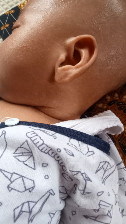Masalah kulit bayi