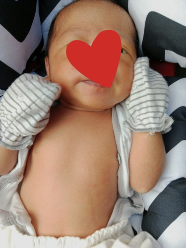 Bayi kuning