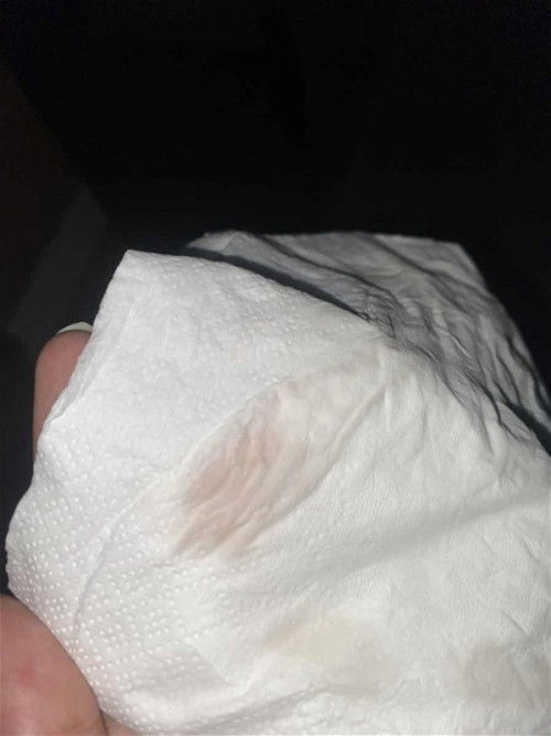 air ketuban atau bukan ya