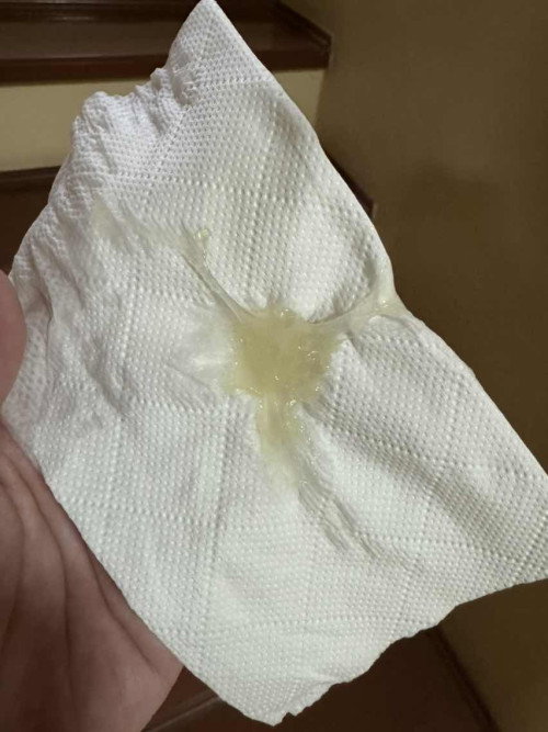 มูกขาวขุ่น 38W