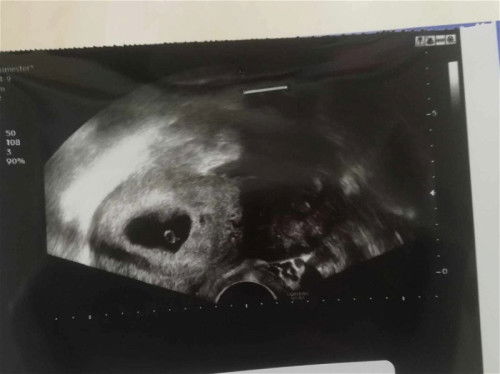 น้องมีโอกาสเป็นตัวไหม?