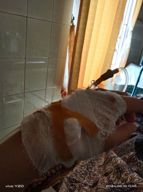 Hpl 10 juni udah lahir alhamdulillah. Dengan brat 3,6 kg jk baby boy normal alhamdulillah.