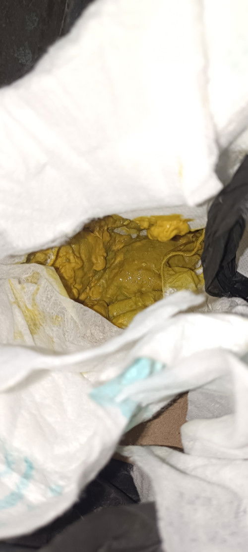 Bab bayi kuning kehijauan