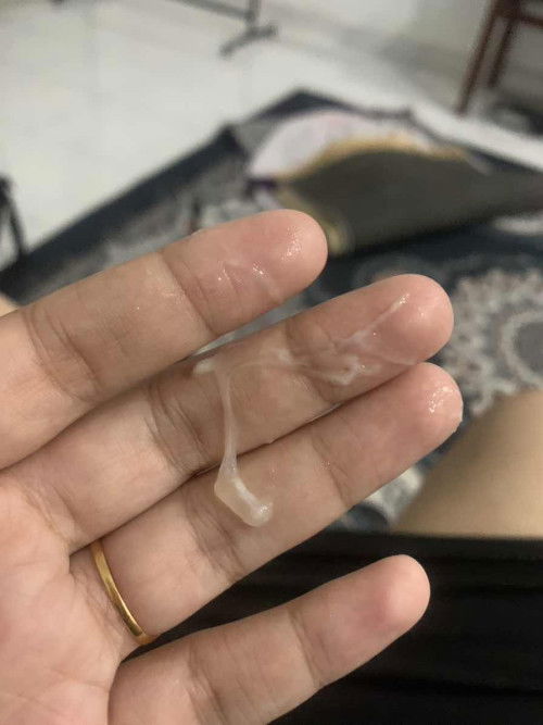 KEPUTIHAN INI NORMAL ATAU TIDAK