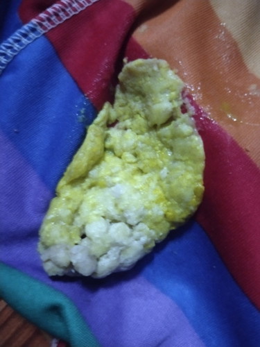 น้องิอึสีแบบนี้ผิดปกติไหมคะ