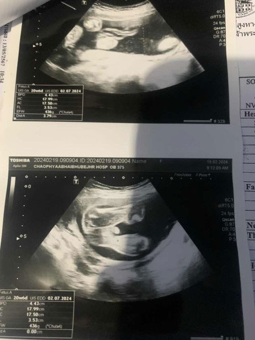 มีแม่ท่านไหนดูเป็นมั่งค่ะน้องเป็นผู้หญิงหรือผู้ชายค่ะ