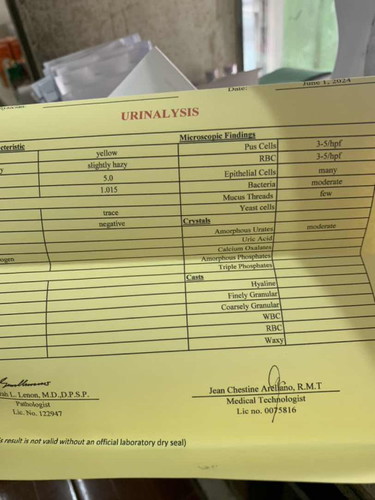 Urinalysis mii pa tingin nga po