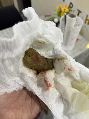 Najis berdarah