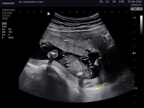 แบบนี้ลูกสาวชัวไหมค่าา