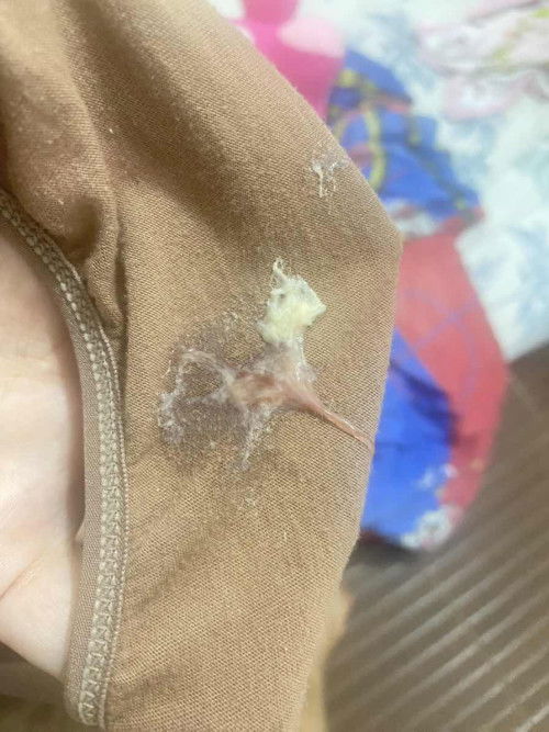 Keputihan kuning bercampur lendir darah