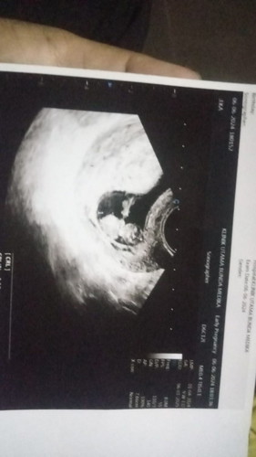 Ass. Bunda2 disini ada yg sama atw sdah berpengalaman riwayat lahir sesar ank bru 1th udh hamil lagi
