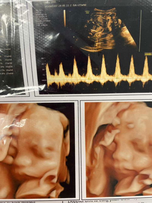 Ăn gì để con tăng cân trong bụng mẹ?