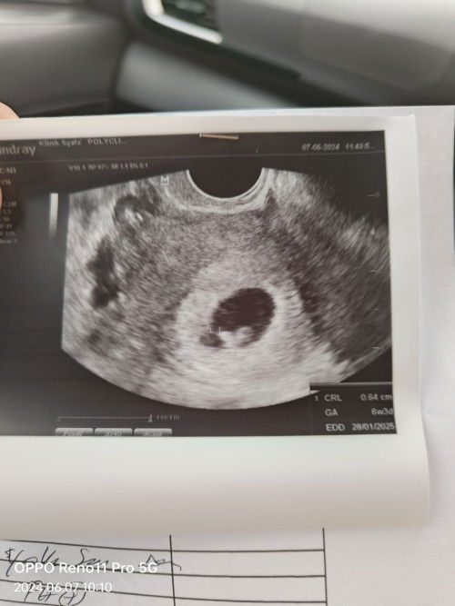 Kandungan 6 minggu 6 hari