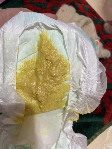 Pup bayi kuning pucat
