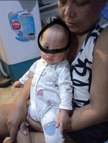 Normal po ba ito sa baby? yung parang may guhit sa noo