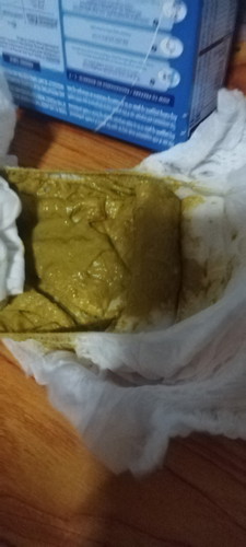 1 yr old po baby ko ngkaroon ng amoeba naggamot napo kame ng 7 day pero malambot pa den poops nya