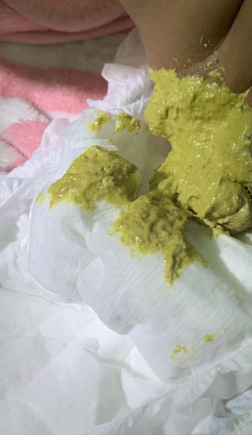 เสริมนมผงงง