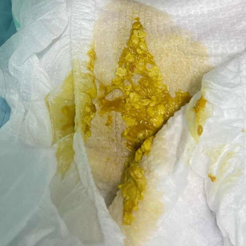 NORMAL KE NAJIS MACAM NI 3 BULAN NAK MASUK 4 BULN FULLY FORMULA