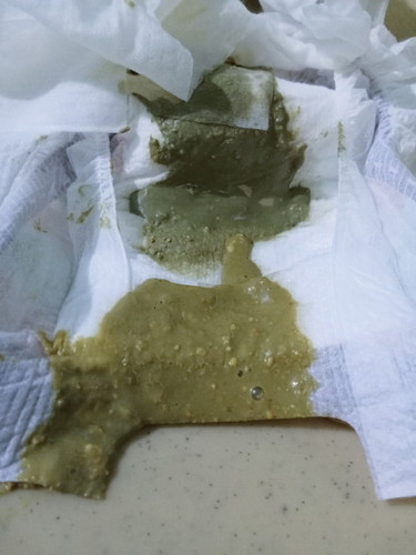 Watery green poops ni baby
