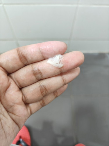 Keputihan masa mengandung