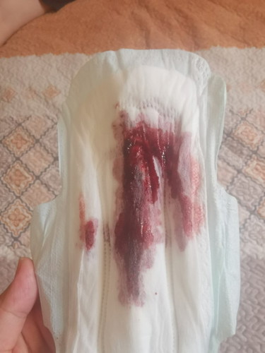hello normal lang po ba to last men's ko po may6 nag pt po ako positive tpus may lumabas ganito