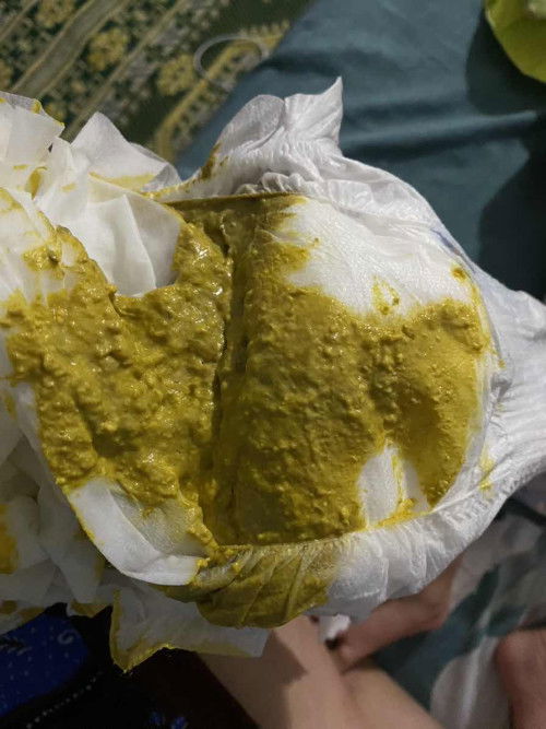 Bayi 2 bulan 10 hari